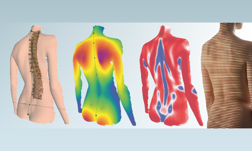 Rappresentazione 3D dell’analisi della colonna vertebrale e postura con il sistema Formetric 4D.