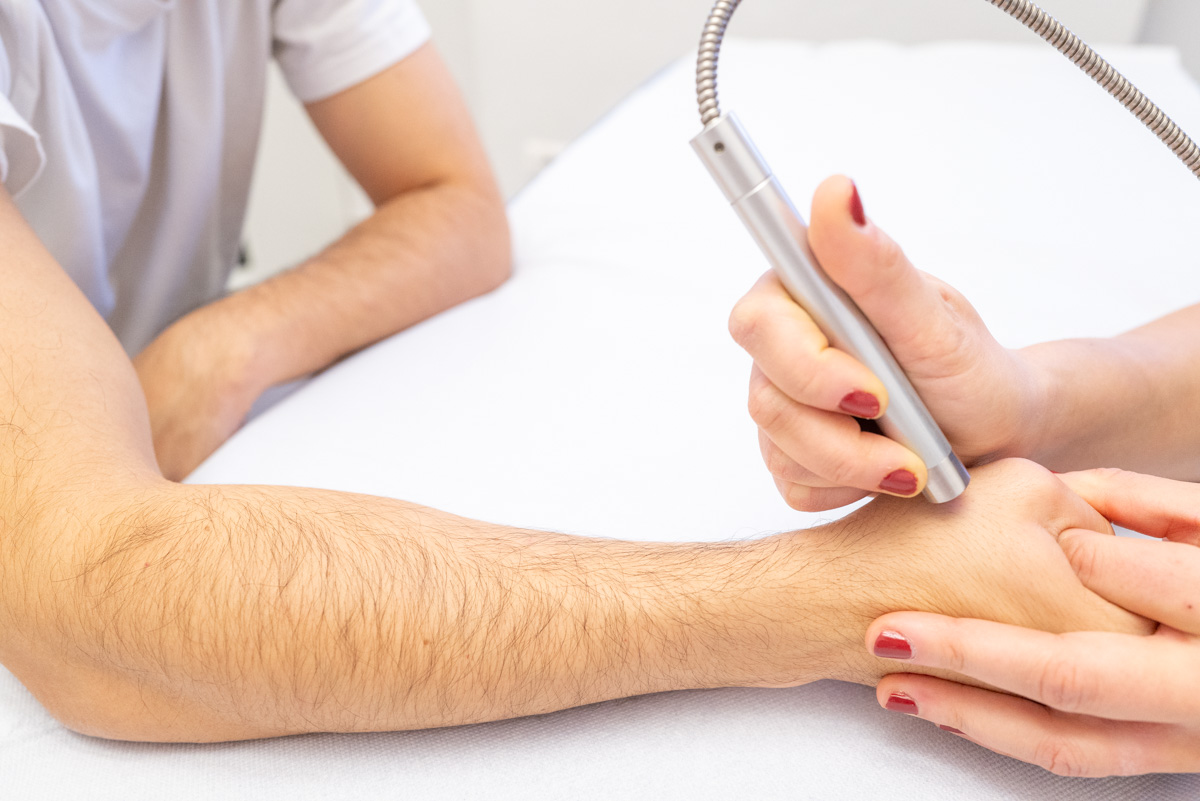 Trattamento di laser terapia su una mano per ridurre dolore e infiammazione.