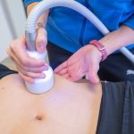 Terapeuta effettua un trattamento di cryoterapia sulla pancia di un paziente steso su un lettino.