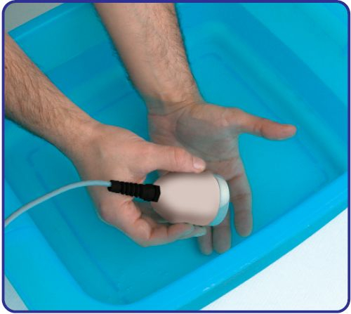 Terapia a ultrasuoni in acqua su mano con manipolo Bisonic